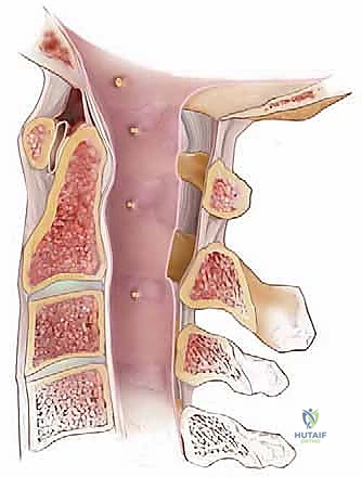 تفصيل دقيق لنقاط ارتكاز العضلات على قاعدة الجمجمة