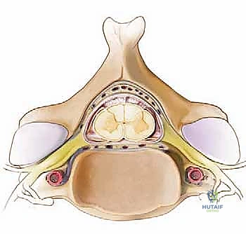 صورة توضيحية لـ تخفيف الضغط الخلفي ودمج الفقرات العنقية: دليل المريض الشامل مع الأستاذ الدكتور محمد هطيف في صنعاء
