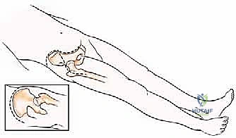 Clinical Image