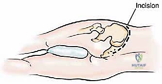 Clinical Image