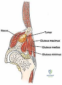 Clinical Image