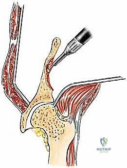Clinical Image