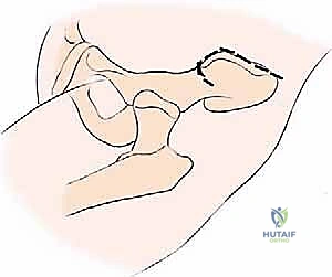 Clinical Image