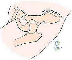 Clinical Image