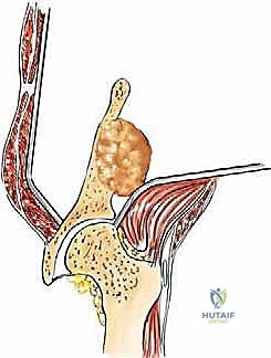 Clinical Image