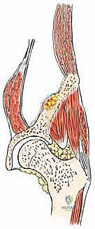 Clinical Image