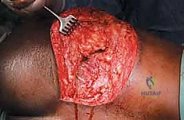 Clinical Image