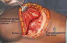 Clinical Image
