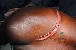 Clinical Image