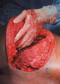 Clinical Image