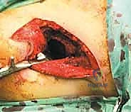 Clinical Image
