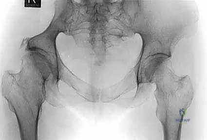 Clinical Image