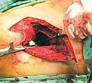 Clinical Image