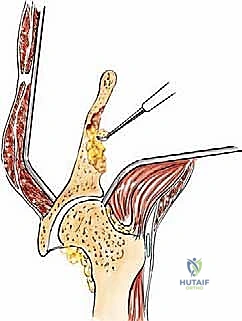 Clinical Image