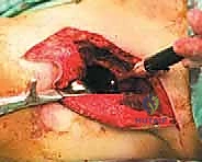 Clinical Image