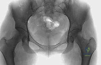 Clinical Image