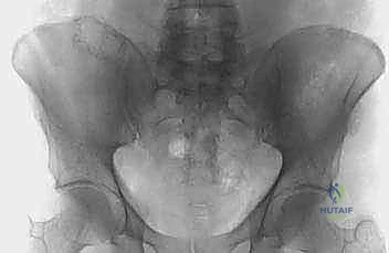 Clinical Image