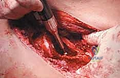 Clinical Image