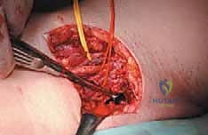 Clinical Image