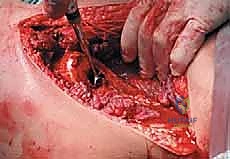 Clinical Image