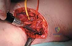 Clinical Image