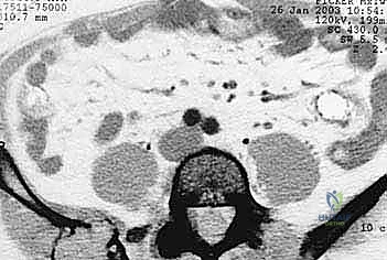 Clinical Image