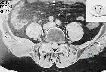 Clinical Image