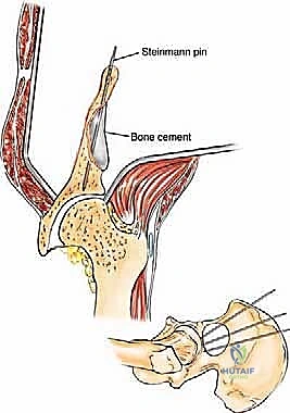 Clinical Image