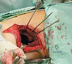 Clinical Image