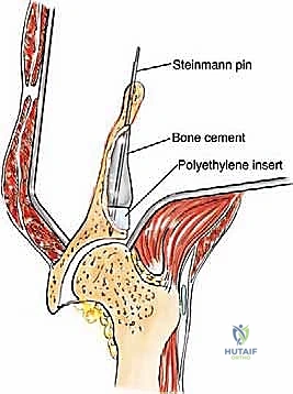 Clinical Image