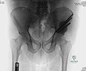 Clinical Image