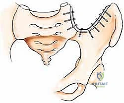 Clinical Image