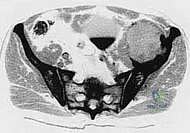 Clinical Image