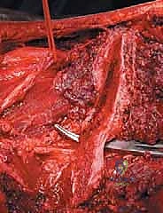 Clinical Image