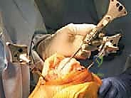 TECH FIG 3 continued E