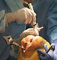 TECH FIG 3 continued E