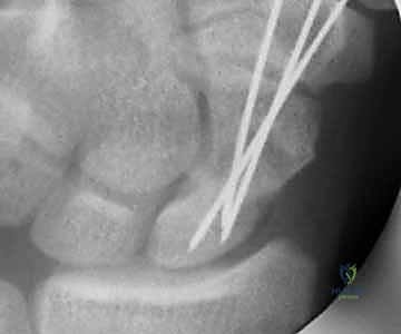 Clinical Image
