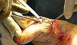 الفحص السريري للقدم