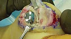 فحص نطاق حركة المفصل