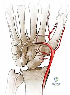 أشعة قبل وبعد العملية