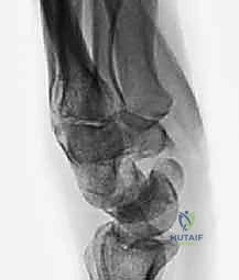 الأستاذ الدكتور محمد هطيف أثناء الجراحة