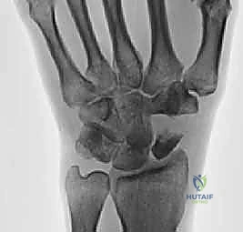 Clinical Image
