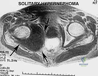 التخدير ووضعية المريض