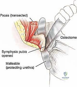الإصابات الرضية الشديدة