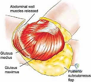 العلاج الطبيعي وإعادة التأهيل