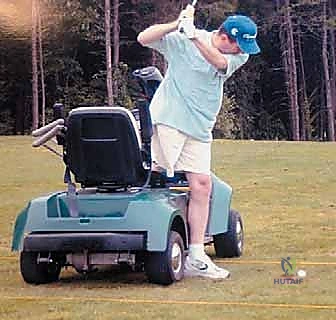 صورة توضيحية لـ عملية بتر النصف الحوضي الخلفي: دليل شامل للمرضى مع الأستاذ الدكتور محمد هطيف في صنعاء