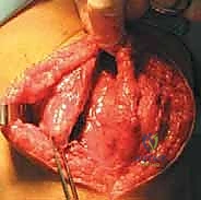 تقييم عدم استقرار الرضفة والأشعة التشخيصية