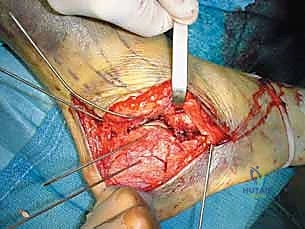 التحقق من ثبات الكسر