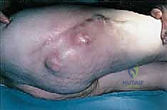 Illustration of fig tech fig - Dr. Mohammed Hutaif