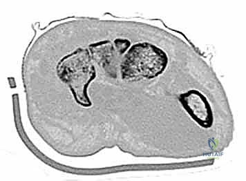 Clinical Image